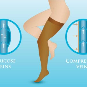 Compression Stocking